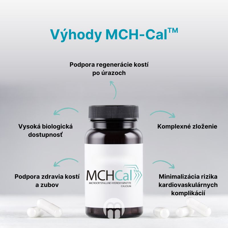 (Slovenčina) Výhody MCH-Cal™️